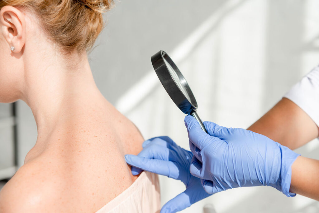 dermatologista