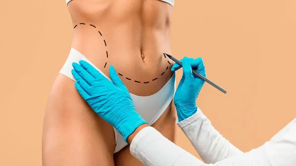 Tratamento de flacidez em Moema